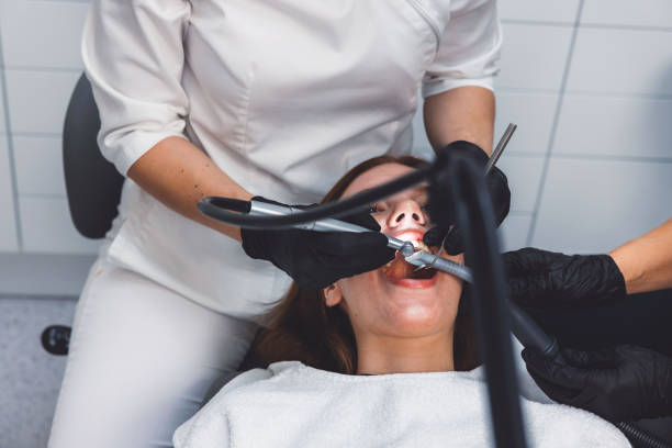 Best Emergency Wisdom Teeth Removal in Penngrove, CA