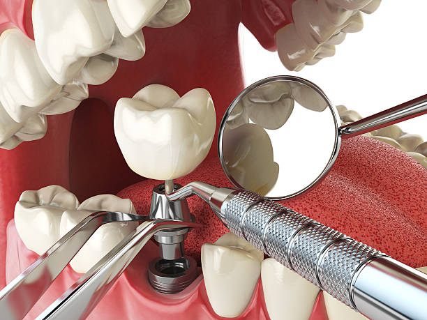 Best Emergency Gum Treatment in Penngrove, CA